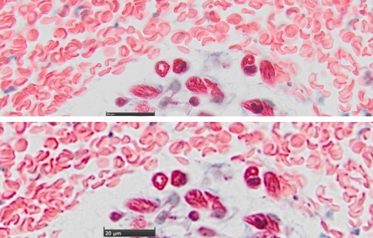 empty magnification blood sample